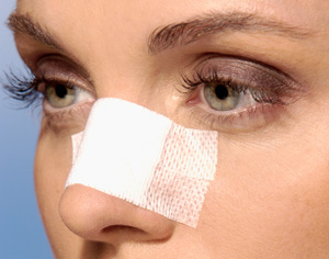 closeup-bandaged-nose-woman-300x236.jpg